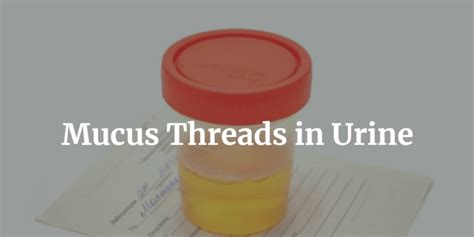 mucus threads in tagalog|Mucus in Urine: MedlinePlus Medical Test.